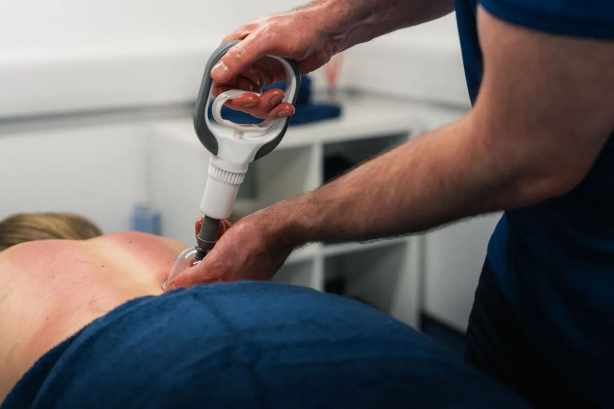 Cupping therapy being applied at Ascension